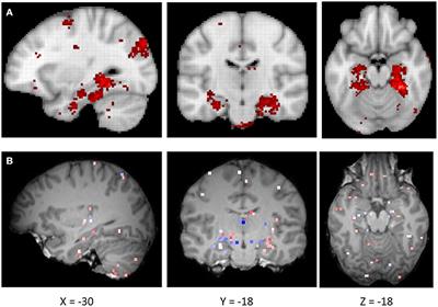 Expression of CRY2 Gene in the Brain Is Related to Human Navigation